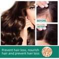 thumbnail image 4 of Suero Para El Crecimiento Del Cabello, La Luz Promueve La Absorción De Nutrientes, Líquido De Regeneración Del Cabello De 60 Ml Para El Hogar, 4 of 7
