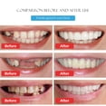 thumbnail image 3 of Carillas dentales de silicona simuladas Carillas dentales flexibles de simulación de sonrisa Cubierta cosmética para dientes Aparatos blanqueadores, 3 of 6