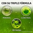 thumbnail image 4 of SISTEMA GB - Solución contra la alopecia. Ingredientes activos que combaten la calvicie bloqueando la enzima que tira el cabello. Frasco y atomizador con 60ml, 4 of 9