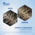 thumbnail image 5 of Shampoo Head & Shoulders Anti-Resequedad Nutrición Diaria, Miel Aceites y Esenciales 180 ml, 5 of 5
