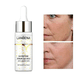 thumbnail image 3 of Kit Dermapen Lanbena 5 Serum Acido Vitamin C Pestañas Labios, 3 of 8