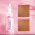thumbnail image 3 of Exfoliante peeling L'oréal anti-manchas niacinamida 25ml, 3 of 6