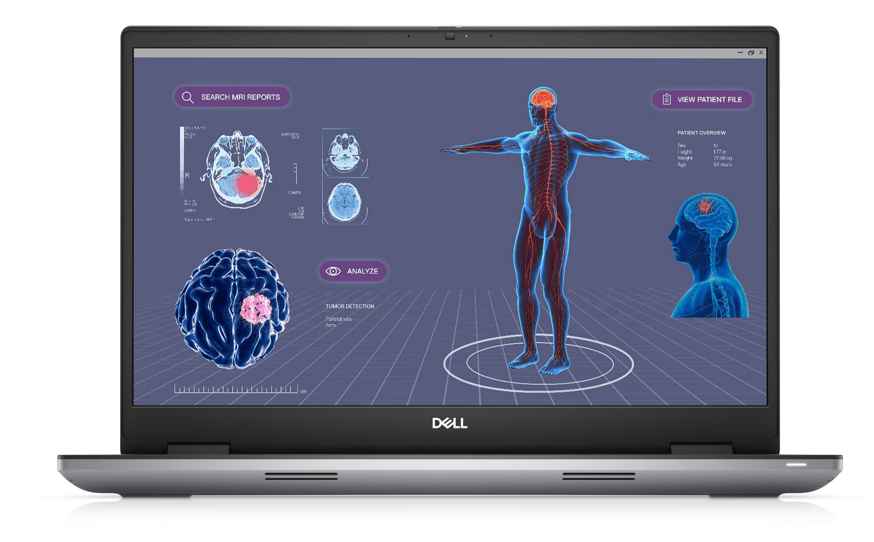 Laptop Dell Precision 7780 Intel Core i5-13600HX 4.8GHz, 32GB, 512 SSD NVIDIA RTX 2000 de 8GB,W11Pro