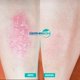 thumbnail image 2 of Jabón Para Psoriasis y Dermatitis , Dermabon 2 pzas, 2 of 3