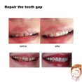 thumbnail image 3 of Advancent Accesorio Dental ajuste seguro dentadura postiza pegamento sólido ajuste cómodo diente temporal pegamento sólido fácil Kits de decoración para fiestas, 3 of 6