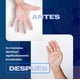 thumbnail image 4 of SKINDRY Desodorante Mujer y Hombre para Sudoración Excesiva | 72 hrs de Protección | Antitranspirant, 4 of 9