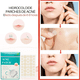 thumbnail image 4 of 72 Parches Invisibles Cubre Acne Espinillas Granos Facial, 4 of 7