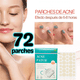 thumbnail image 2 of 72 Parches Invisibles Cubre Acne Espinillas Granos Facial, 2 of 7