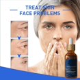 thumbnail image 3 of Sérum Biuhorey Olavita Botox con vitamina C y E antienvejecimiento 3x30 ml, 3 of 6
