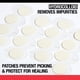 thumbnail image 5 of Parches para acné y espinillas, 24 parches para acné persistente de Neutrogena, 5 of 5