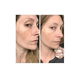 thumbnail image 4 of Retinol .5% in Squalane The Ordinary 30 ml, 4 of 4